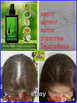 10 Neo Hair Lotion Green Wealth Hair Loss Treatment Hair Growth Authentic 120ml