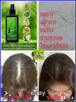 10 bottles 4oz Neo Hair Lotion Growth Root Hair Loss Treatments beards sideburns
