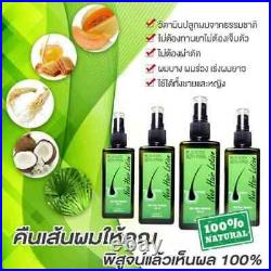 10x Neo Hair Green Wealth Lotion Growth Root Hair Loss Nutrients Treatments
