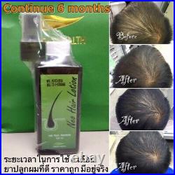 15X NEO Hair Lotion Root Hair Treatment Nutrients Herbals Effectively Longer DHL