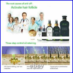 200ml Dexe Hair Shampoo Anti hair Loss Chinese Herbal Hair Growth For Men&Women