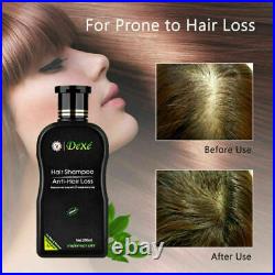 200ml Dexe Hair Shampoo Anti hair Loss Chinese Herbal Hair Growth For Men&Women