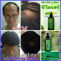 24x 120ml. Neo Hair Lotion Hair Root HAIR BEARD SIDEBURNS LONGER Herbs 100%