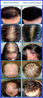 272 Medical Diodes Laser Cap(LLLT)FDA Cleared Hair growth, regrowth, Hair Loss