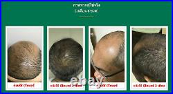 30 bottles 4oz Neo Hair Lotion Growth Root Hair Loss Treatments beards sideburns
