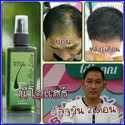 4 x120ml Neo Hair Lotion Root Treatment Nutrients Beard Hair Growth 100% Natural