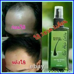 4 x120ml Neo Hair Lotion Root Treatment Nutrients Beard Hair Growth 100% Natural