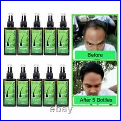 5X Neo Hair Lotion Root Treatment Nutrients Green Wealth Longer 120 ml Express
