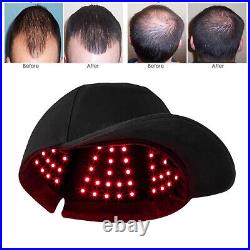 630/850/940nm 150LEDS Light Therapy Cap Treatment Hair Growth Cap For Hair Loss
