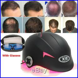 64/128 Diodes Laser Hair Loss Treatment Germinal Cap Hat Regrowth LLLT Promoter