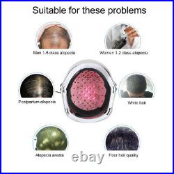 650nm 45 Diodes LLLT Hair Low Light Laser Treatment Hair Growth/Loss /Helmet