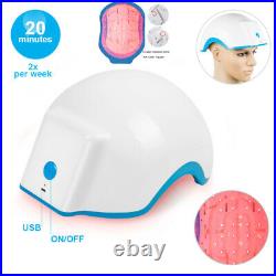 80 Diodes Laser Hair Loss Regrowth Growth Treatment Cap Helmet Therapy