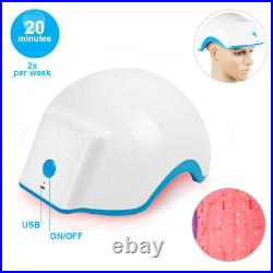 80 Points Hair Loss Regrowth Growth Treatment Cap Helmet Therapy Massage Device