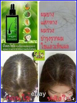 8 Neo Hair Lotion Hair Loss Treatment Hair Growth Green Wealth Original 120ml