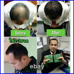 8 Neo Hair Lotion Hair Loss Treatment Hair Growth Green Wealth Original 120ml