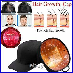 94 Laser Diodes Helmet/Cap Fast Hair Regrowth Hair Loss Lase Therapy Hat 650nm