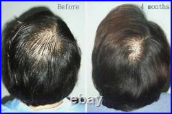 BEST Hair Tonic Havilah Regenerate Growth Prevention Reviving Anti Hair Loss