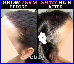 BEST SUPER FAST Hair Growth System Natural Hair Growth Products KIT of 3