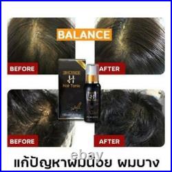 BalanceH Hair Tonic Spray Scalp Treatment Alopecia Hair Loss Treatment 2x100ml
