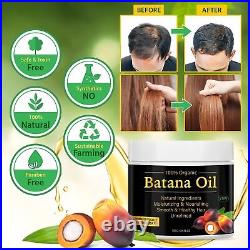 Batana Oil for Hair Growth -100% Natural Prevents Hair Loss, Eliminates Spli