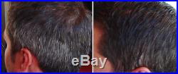 Cure For Grey White Hair Organic Natural Shampoo Get Shiny Black Dark Hair Again