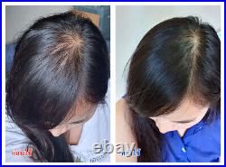 DHL Express Beauty Award 2017 3X Zane Hair Tonic Scalp Care Stimulate Growth