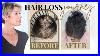 Hair Loss In Women Dr Approved Treatments Shampoos U0026 Thin Hair Hairstyles Tips Dominique Sachse