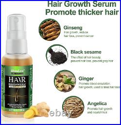 IBEALEE Ginger 20ml Fast Hair Growth Serum Spray Hairdressing Oil Loss Treatment
