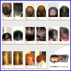 Illumiflow FDA Cleared 148 Laser Cap For Hair Regrowth (Refurbished)