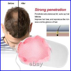 Infared Lamp Hair Loss Regrowth Treatment Laser Hair Growth Helmet Unisex