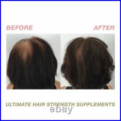 Joyce Giraud Ultimate Hair Strength Supplements with Cynatine