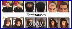 Kaminomoto Hair Loss and Growth Acceleration Gold 150m Japan No. 1 Hair Tonic
