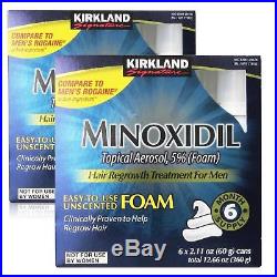 Kirkland Minoxidil Hair Loss Topical Foam 2PK 12mo Mens Treatment Regrowth CHOP