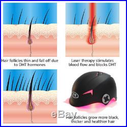LLLT Hair Loss Therapy Laser Cap 128 Diodes Laser Hair Growth System Helmet