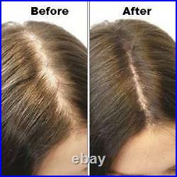 PRO Hair Growth Laser Helmet LED Hair Loss Regrowth Helmet For Thinning Hair
