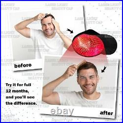 Refurbished Laser Cap 272 Diode Hair Regrowth Treatment Laser Device Men & Women