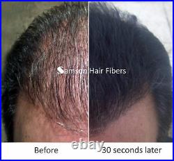 Samson Best Hair Loss Concealer Building Fibers BLACK 300g Refill USA