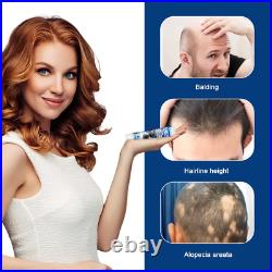 Sumifun Alopecia Treatment Cream Hair Growing Prevent Alopecia Baldness Regrowth