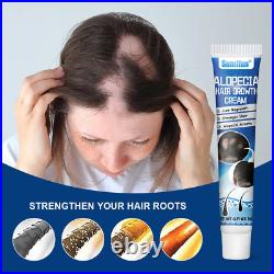 Sumifun Alopecia Treatment Cream Hair Growing Prevent Alopecia Baldness Regrowth