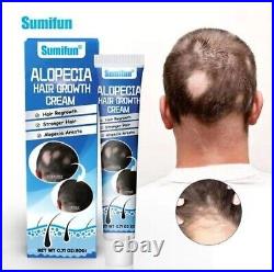 Sumifun Alopecia Treatment Cream Hair Growing Prevent Alopecia Baldness Regrowth