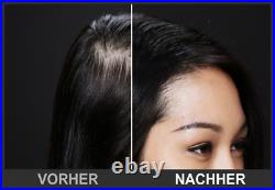 TOPPIK 3x 55 g. Hair compressor scattered hair hair compaction bulk hair fibers
