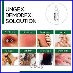 Treat Demodicosis Demodex Acne Rosacea Blepharitis Eczema, Seborrheic Dermatitis